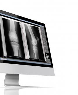 Digitales Röntgen, Monitor mit Röntgenbild